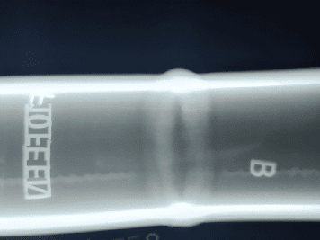 Radiographic Testing